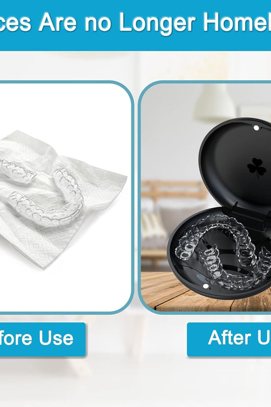 2 Pack Aligner and Retainer Case, Slim Aligner Case Compatible with Invisalign, Mouth Guard Case, Orthodontic Case, Teeth Braces Case, Night Guard Case Container Storage Holder Black. - Velinare