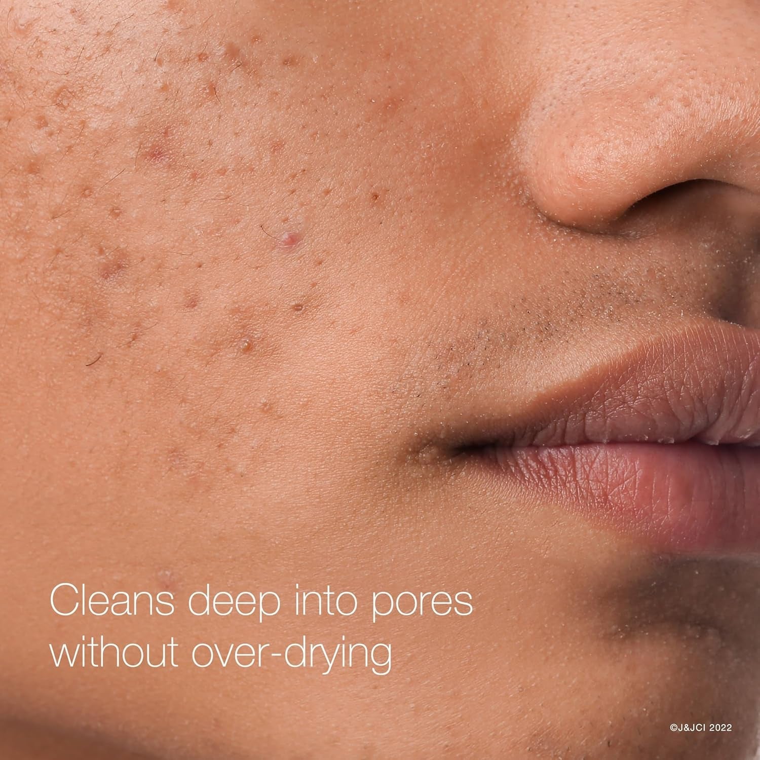 Rapid Clear Maximum Strength Acne Face Pads, for Acne Prone Skin, Salicylic Acid Treatment to Help Fight Breakouts, Oil - Free Facial Cleansing Pads with 2% Salicylic Acid Treatment, 60 Count - Velinare